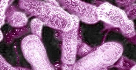 si&ecirc;u vi tr&ugrave;ng, ung thư, bệnh gout, &aacute;p huyết cao, củ cải đường