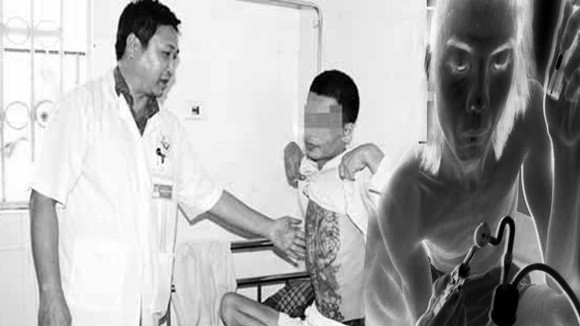 Ma túy đá để lại nhiều hậu quả to lớn cho xã hội. Ảnh minh họa