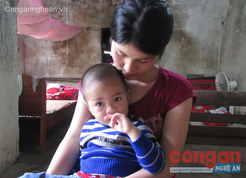Cháu Đạt mới 3 tuổi nhưng mang trong mình 3 căn bệnh câm điếc bẩm sinh, tim bẩm sinh và lõm lồng ngực