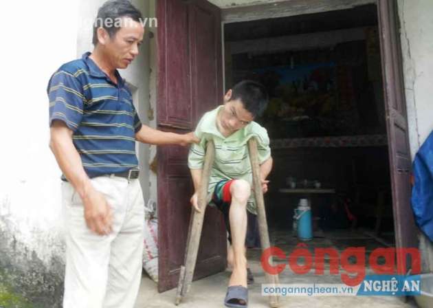 Mọi hoạt động của Dung cần sự giúp đỡ của bố mẹ