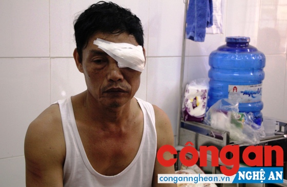 Ông Tâm bị thương ở vùng mắt, phải khâu 8 mũi