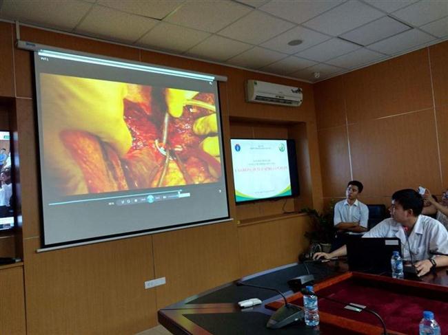 Các bác sĩ giới thiệu hình ảnh ca ghép gan trong buổi họp báo