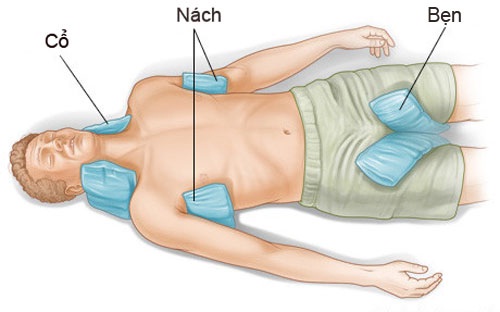 Áp túi nước đá vào nách, bẹn, cổ và lưng bệnh nhân vị sốc nhiệt để làm giảm nhiệt độ cơ thể