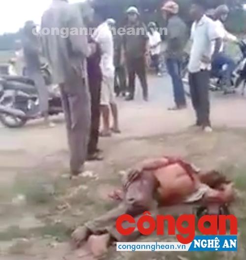 Ông Nguyễn Lê Nga với nhiều vết thương trên cơ thể (Ảnh cắt từ video)