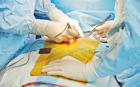 Một bệnh nhân ung thư 75 tuổi ở Mỹ đã được cấy ghép thành công thực quản nhân tạo