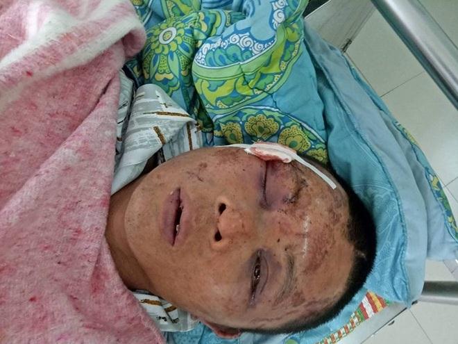 Anh Tuấn bị người dân đánh vì nghi bắt cóc trẻ em.