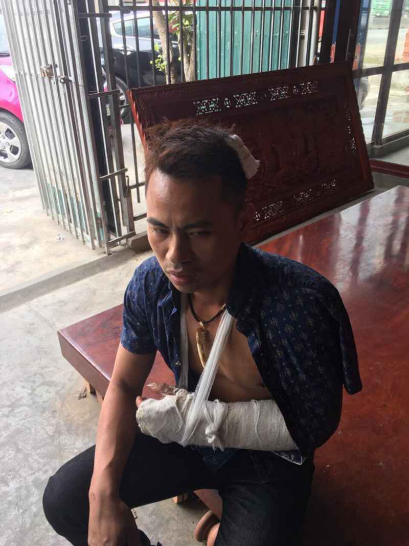 Anh&nbsp;Phạm&nbsp;Văn&nbsp;Thảo&nbsp;bị&nbsp;nhóm đối&nbsp;tượng&nbsp;côn&nbsp;đồ&nbsp;đánh&nbsp;gãy&nbsp;tay