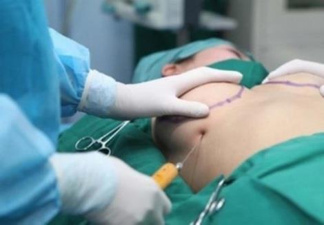 Nhiều nguy cơ biến chứng do làm đẹp.