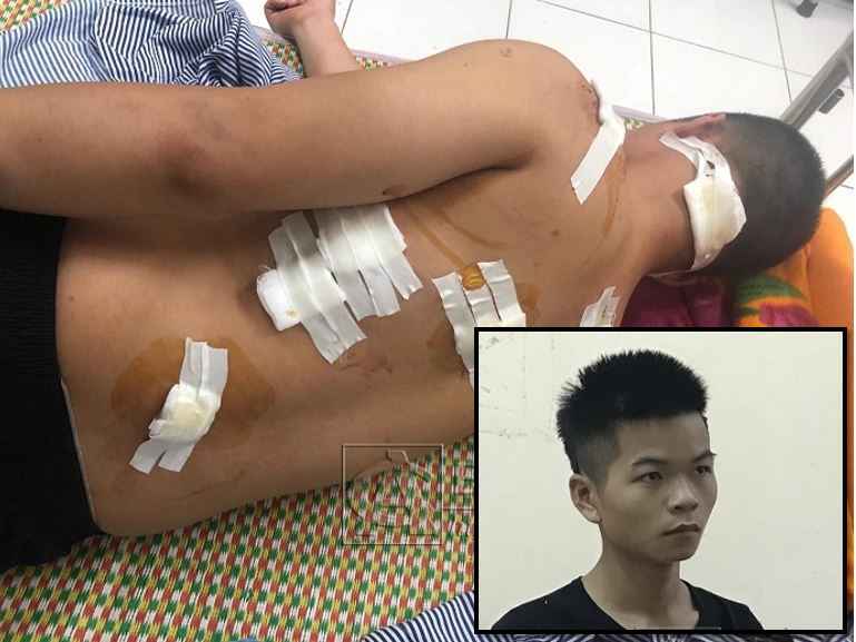 Nạn nhân đang điều trị tại bệnh viện do bị đối tượng (ảnh nhỏ) chém