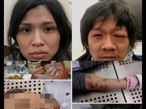 Cặp đôi cha dượng và mẹ đẻ thừa nhận việc đánh đập bé gái 3 tuổi