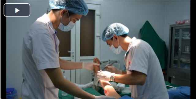 Cảnh giác: Đắp thuốc lá cây gây biến chứng nặng nề