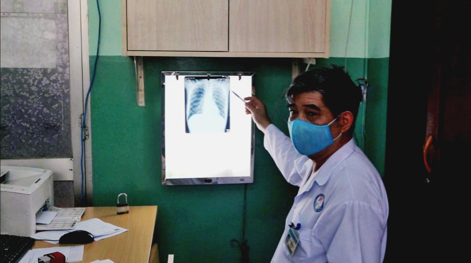  Bác sĩ đang đánh giá một trường hợp lao phổi qua phim X-quang.