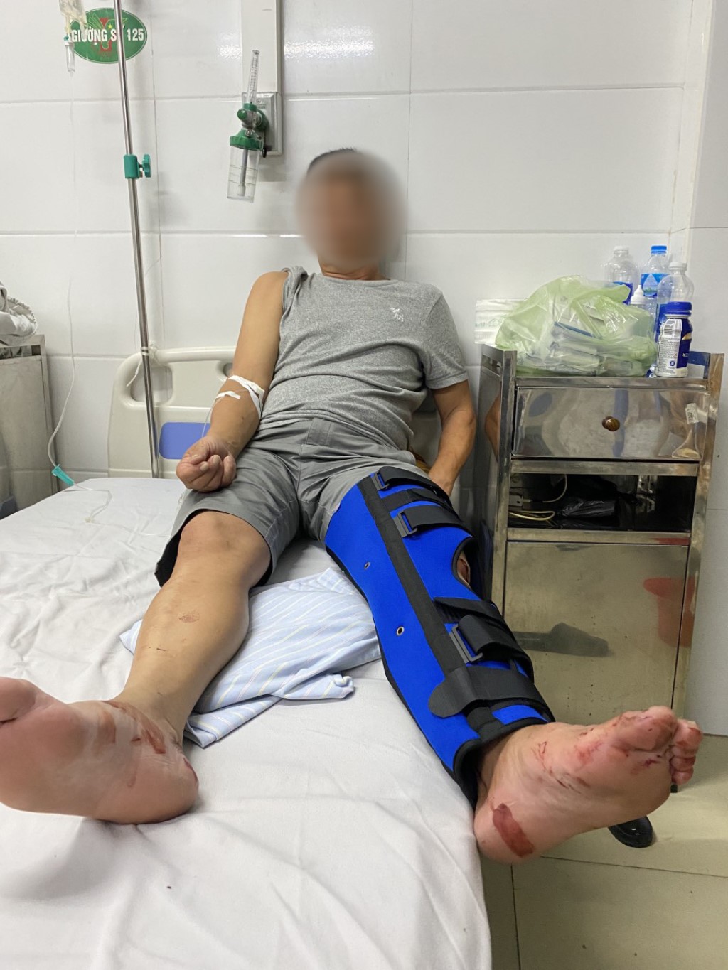 Ông V, nạn nhân bị thương sau vụ chém thuê đang điều trị tại bệnh viện với tỷ lệ thương tích 13%