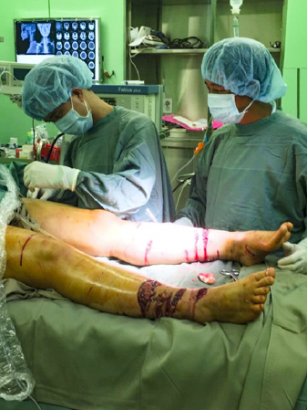 Bác sĩ Phan Văn Tú (bìa trái) thực hiện ca phẫu thuật cấp cứu tại Bệnh viện Bà Rịa.