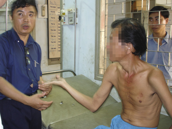 Bác sĩ Đỗ Ngọc Chấn đến thăm và tư vấn, hướng dẫn một bệnh nhân phong tuân thủ tập luyện, điều trị tại nhà. 