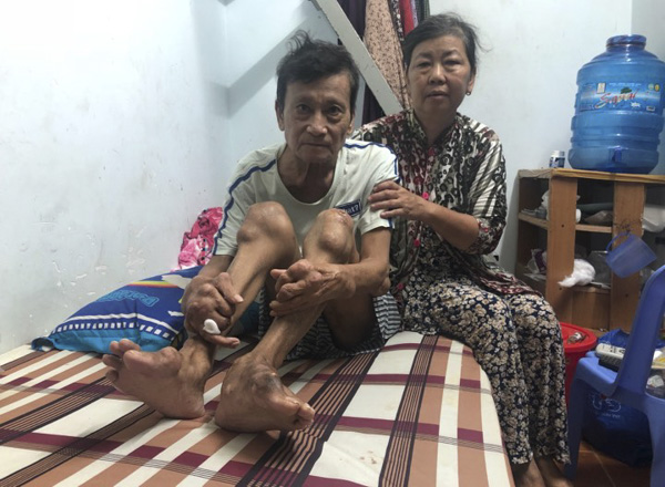 Do không có tiền điều trị bệnh nên ông Phạm Kỷ đang phải chịu đựng đau đớn do bệnh tật gây ra.