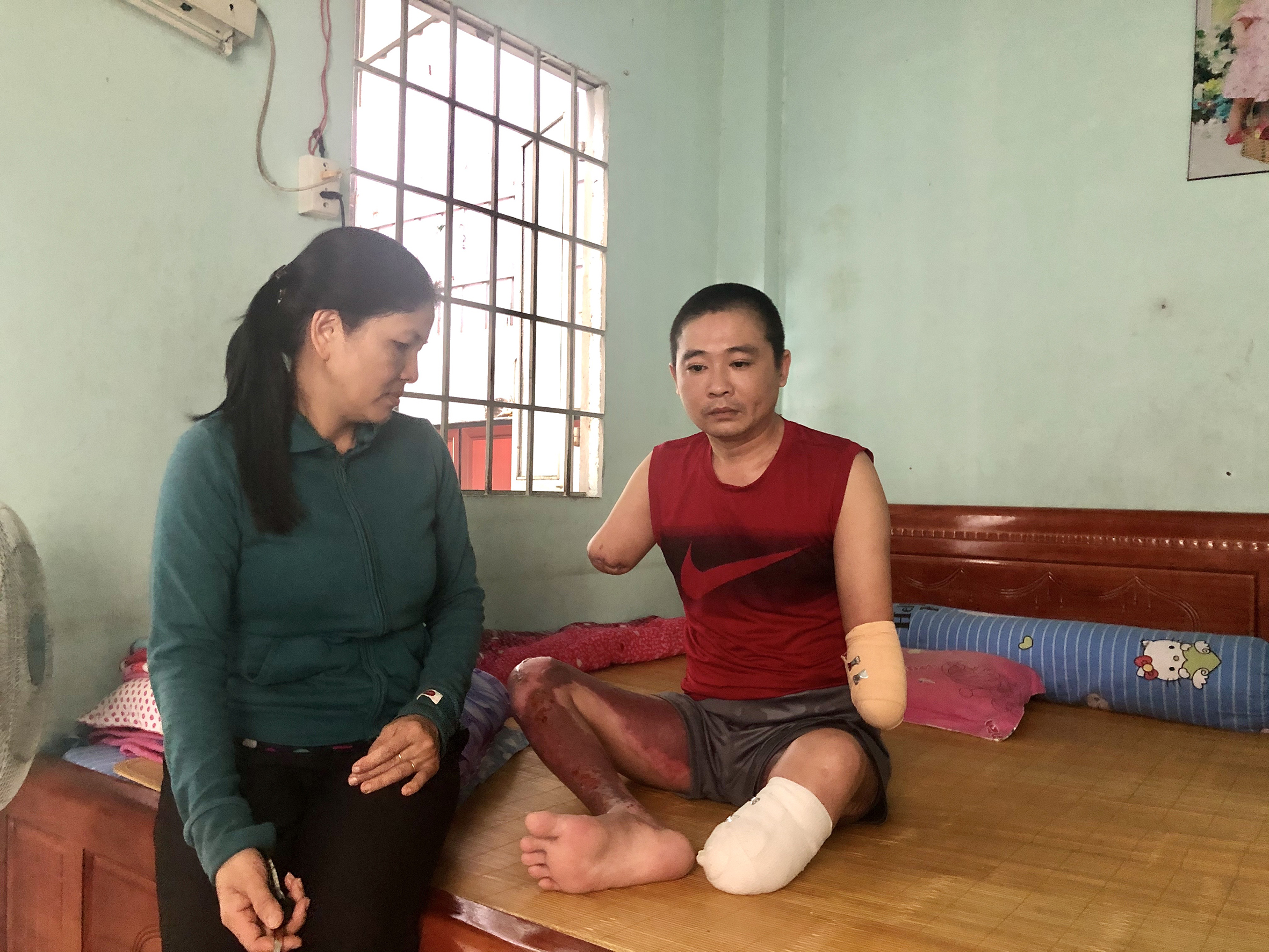Vụ tai nạn khiến anh Tạ Công Hậu mất đi đôi tay và 1 chân của mình.