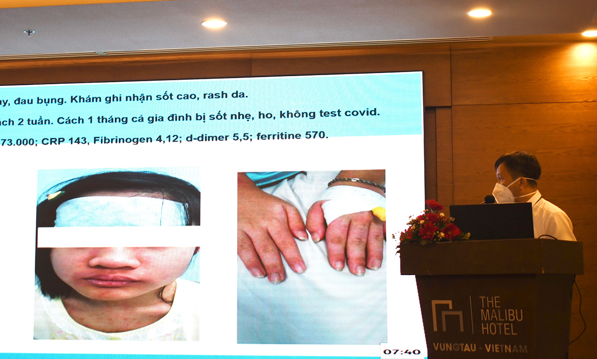 PGS.TS.BS. Phùng Nguyễn Thế Nguyên, Chủ nhiệm bộ môn Nhi Đại học Y Dược TP. Hồ Chí Minh báo cáo đề tài Hội chứng viêm đa cơ quan liên quan đến trẻ em nhiễm COVID-19.