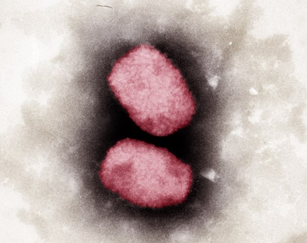 Virus đậu mùa khỉ nhìn dưới kính hiển vi.