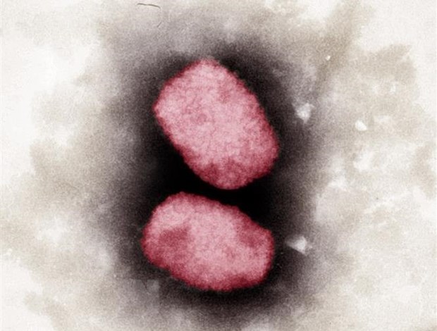 Virus đậu mùa khỉ nhìn dưới kính hiển vi.