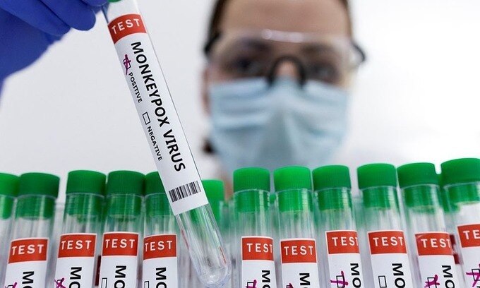 Bộ Y tế đã chủ động chỉ đạo các Viện Vệ sinh dịch tễ/ Viện Pasteur, Sở Y tế các tỉnh, thành phố triển khai các biện pháp sẵn sàng dự phòng đáp ứng với dịch bệnh đậu mùa khỉ. Ảnh: Ảnh: website Sức khỏe và đời sống (Bộ Y tế)