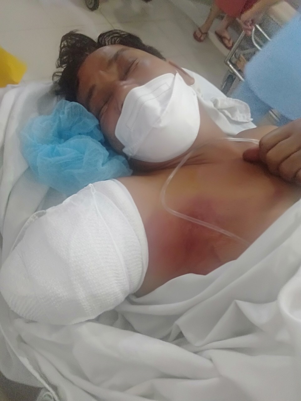 Ngư dân Châu Minh Hoàng được cấp cứu tại Trung tâm Chấn thương Chỉnh hình TP.HCM 4 tháng trước sau tai nạn nghiêm trọng khi đi biển.