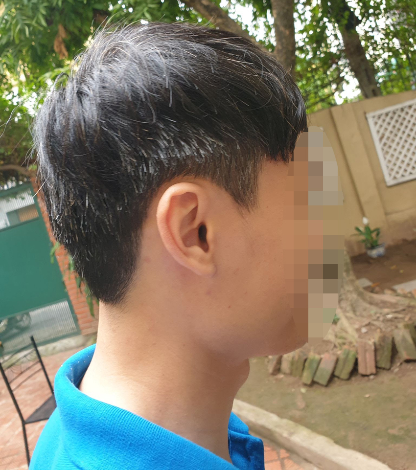 Tóc bạc sớm không phải là vì “máu xấu”.
