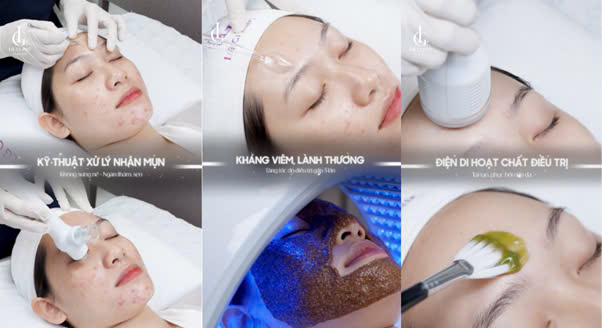 Quá trình trị mụn bằng công nghệ Doctor Laser tại LG Clinic kết hợp nhiều loại máy móc hiện đại, giúp tăng hiệu quả điều trị