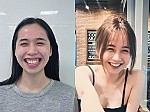 Hotgirl A Nha phẫu thuật hàm hô sau 2 năm tại Bệnh viện răng hàm mặt Paris: Nhan sắc đỉnh cao, thu nhập 8 chữ số